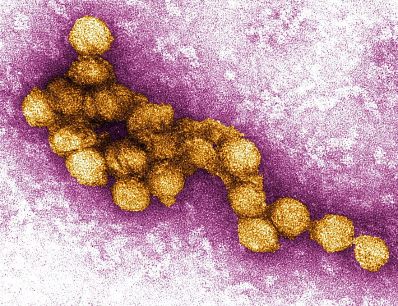 فيروس غرب النيل: الأعراض والعلاج