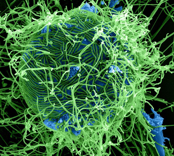فيروسات الإيبولا