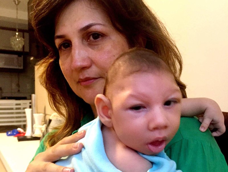 ماريلا ليما ، أم برازيلية ، أصيبت بفيروس زيكا أثناء الحمل.  يعاني ابنها آرثر البالغ من العمر 2.5 شهرًا من صغر الرأس - عيب خلقي يتميز برأس صغير وتلف شديد في الدماغ. 